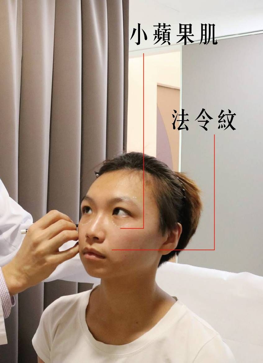 萊波亞