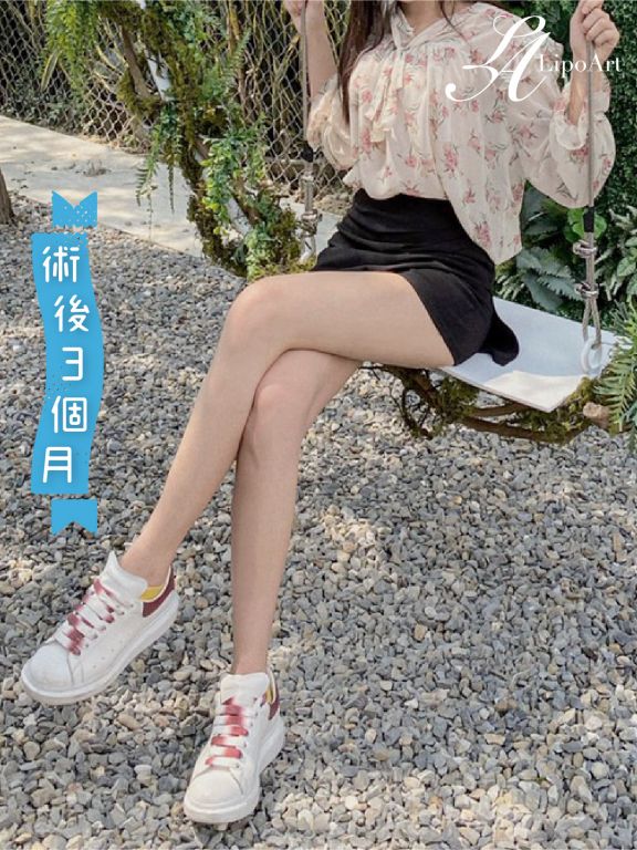 萊波亞