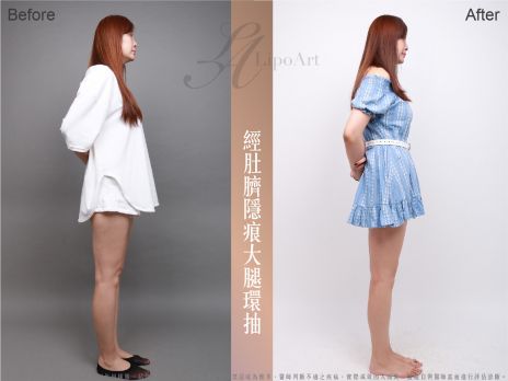萊波亞 