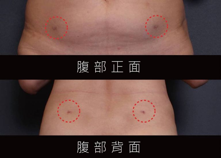 萊波亞
