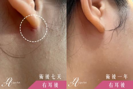 萊波亞