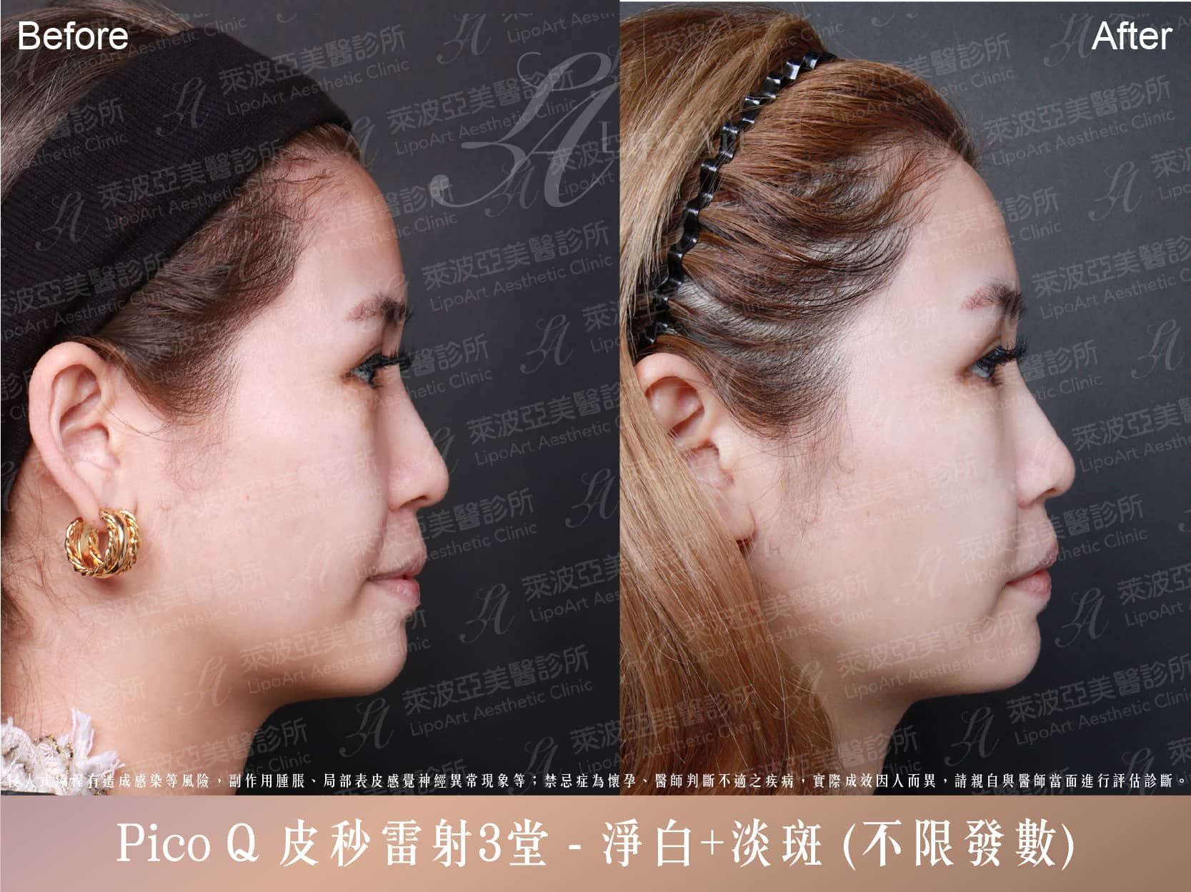 萊波亞 