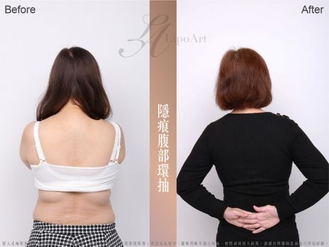 萊波亞