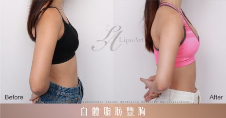 萊波亞 