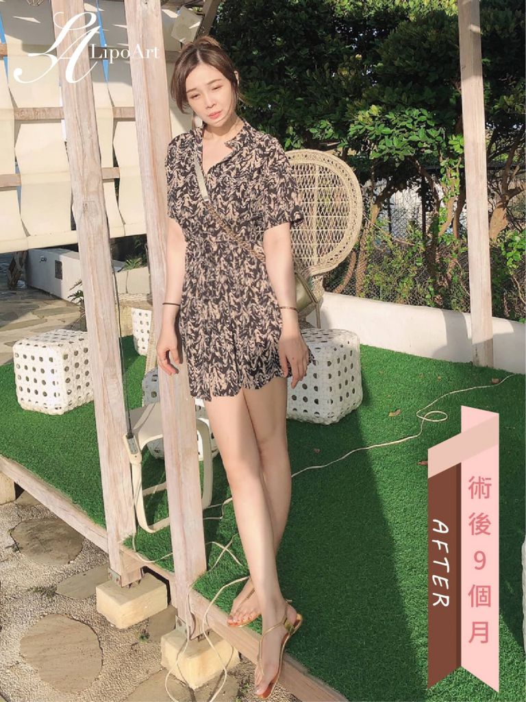 萊波亞