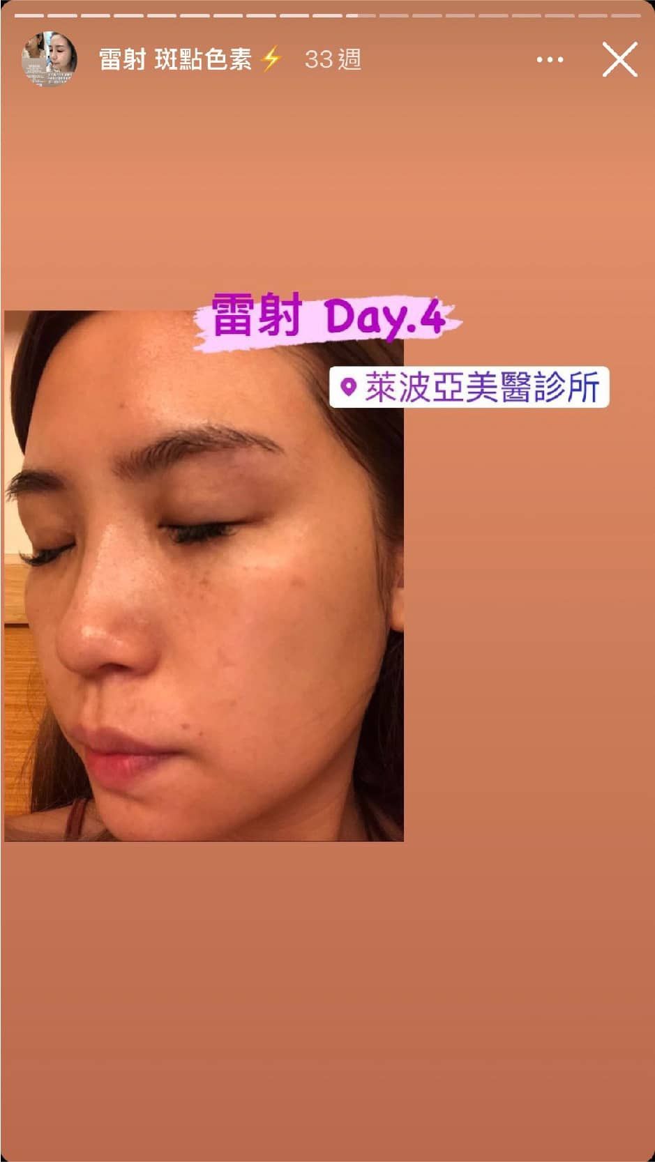 萊波亞