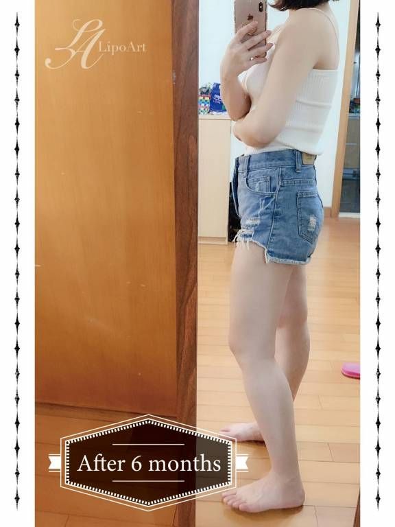萊波亞