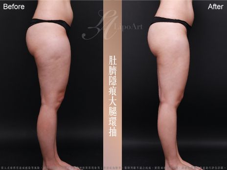 萊波亞 