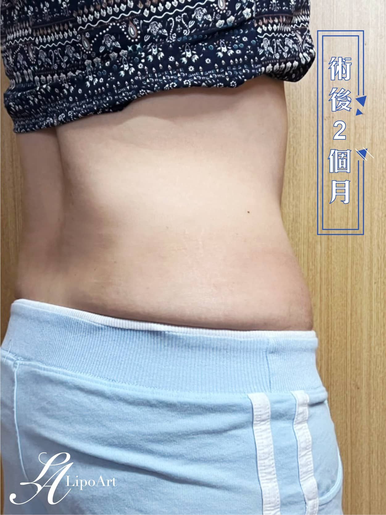 萊波亞