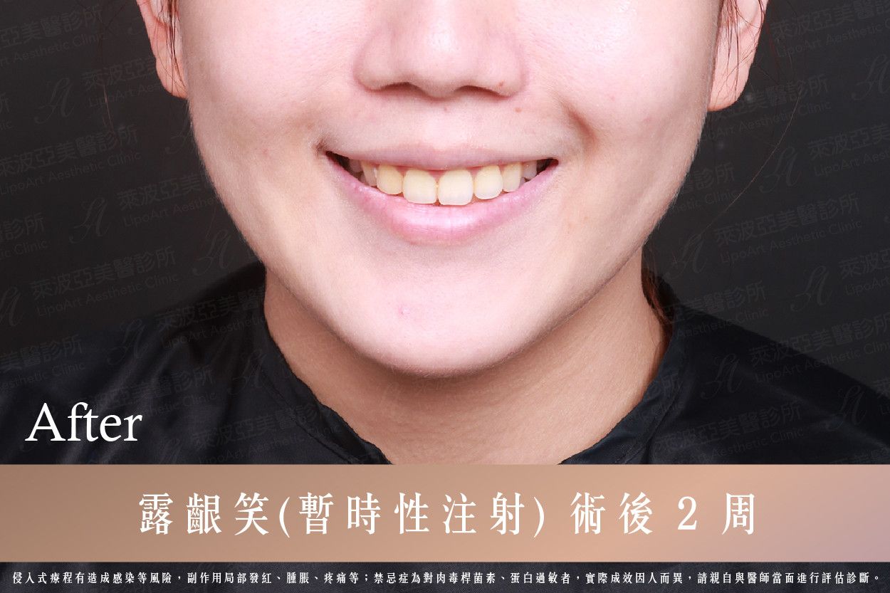 萊波亞