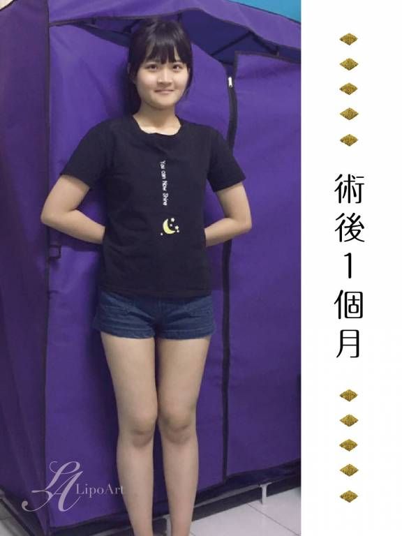 萊波亞