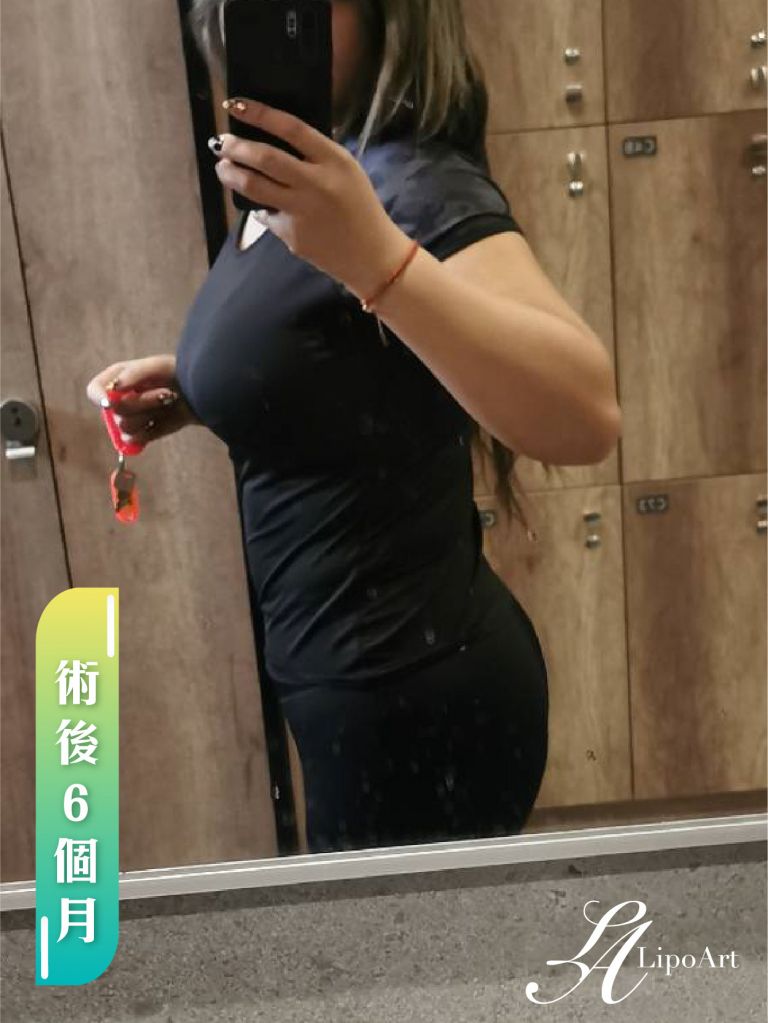 萊波亞