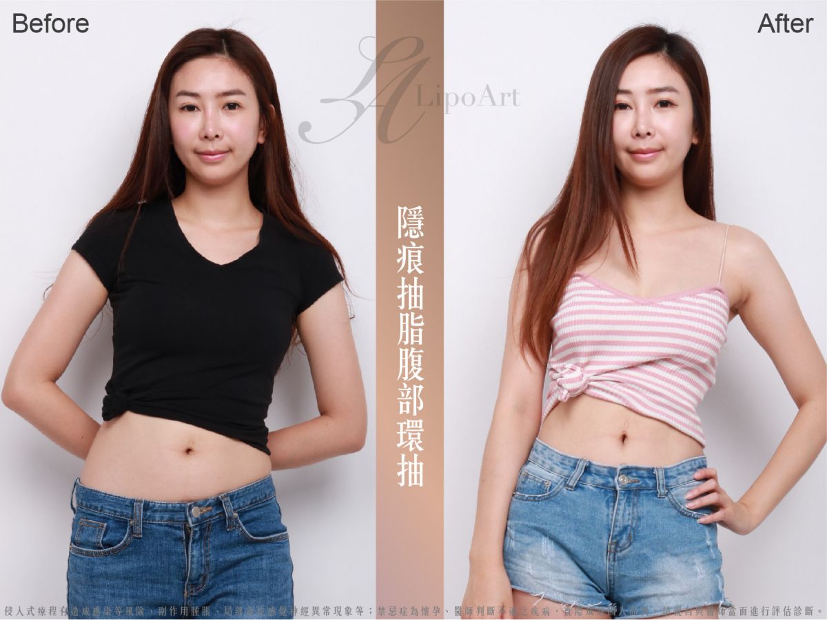 萊波亞