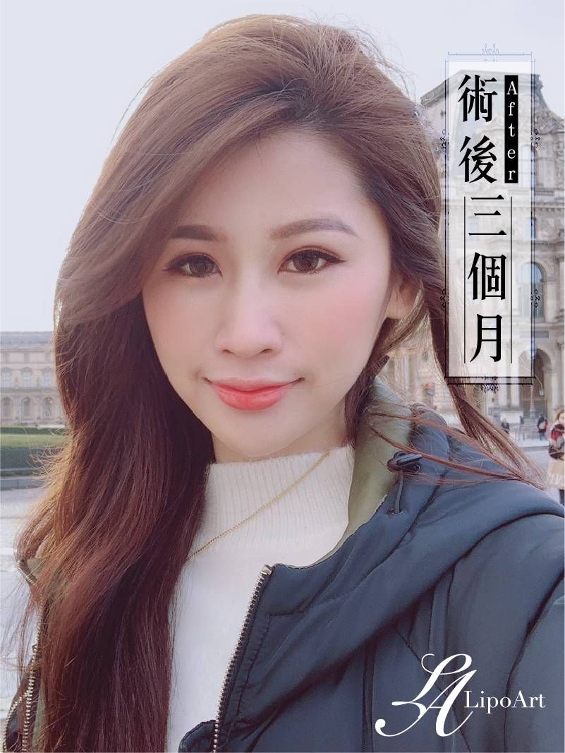 萊波亞