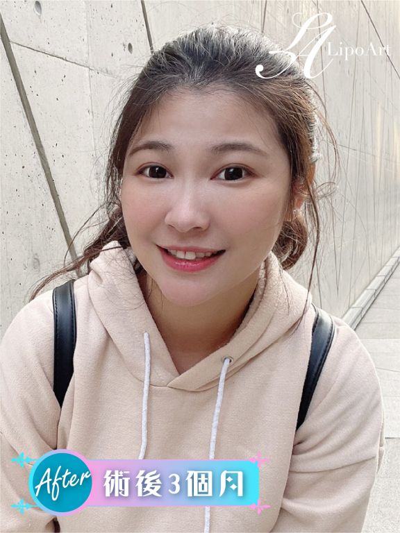 萊波亞