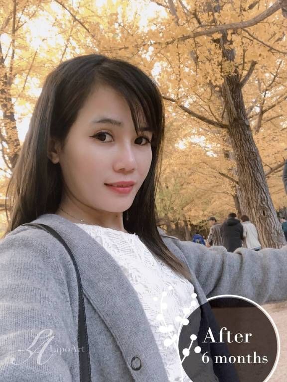 萊波亞