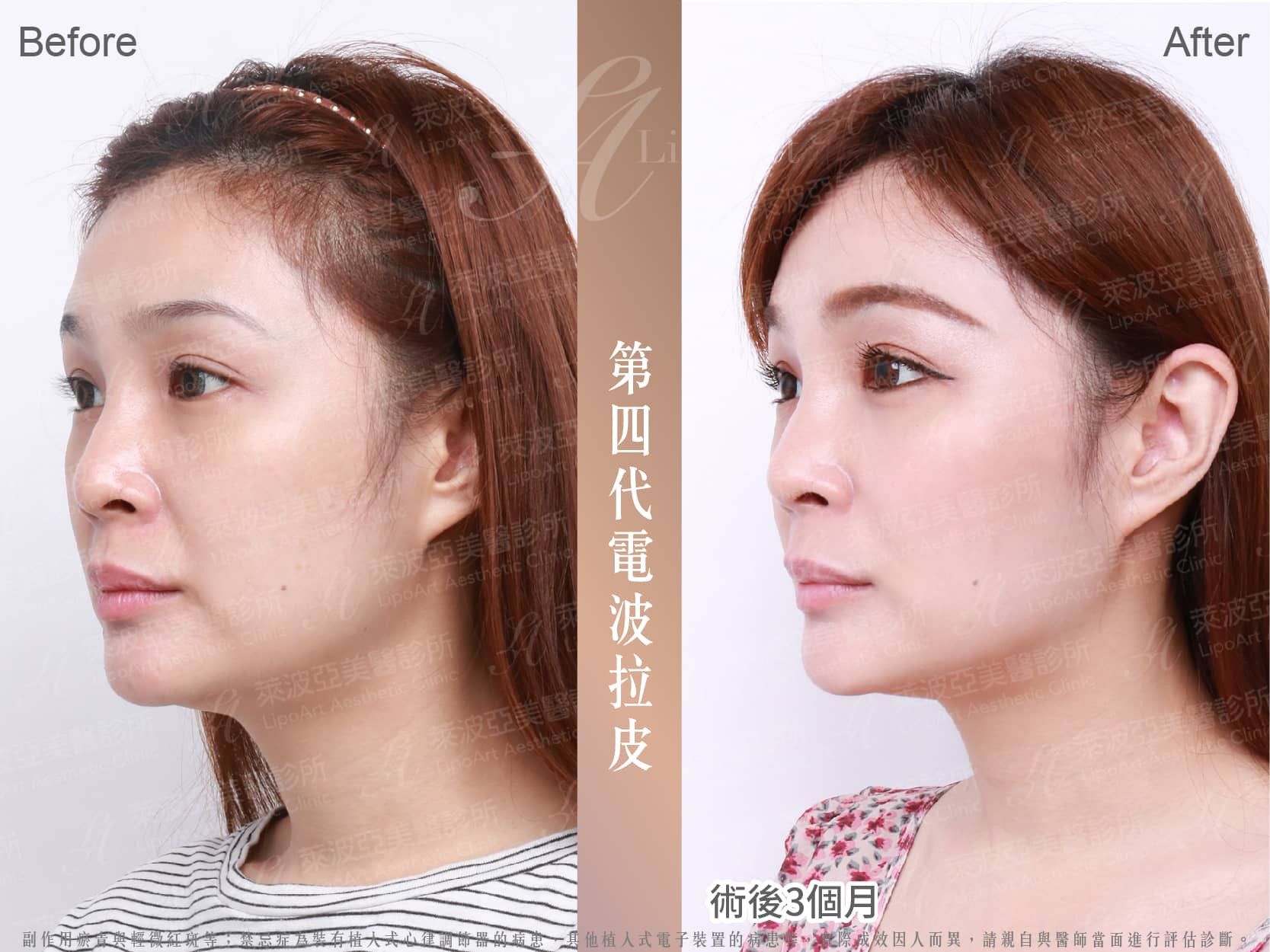 萊波亞 