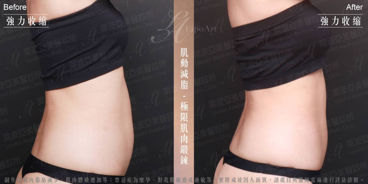 萊波亞