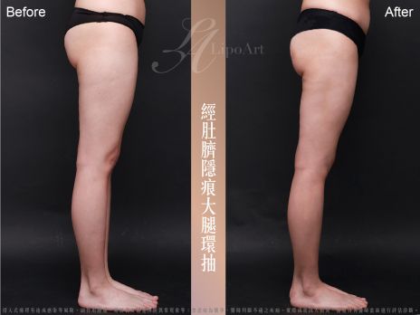 萊波亞 