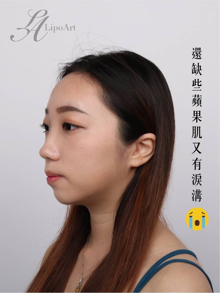 萊波亞