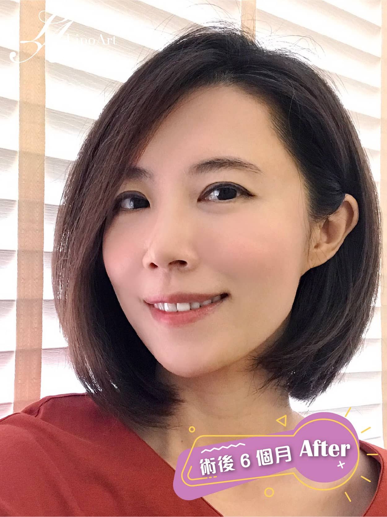萊波亞