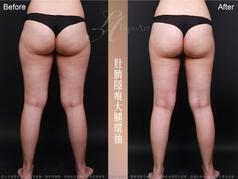 萊波亞 