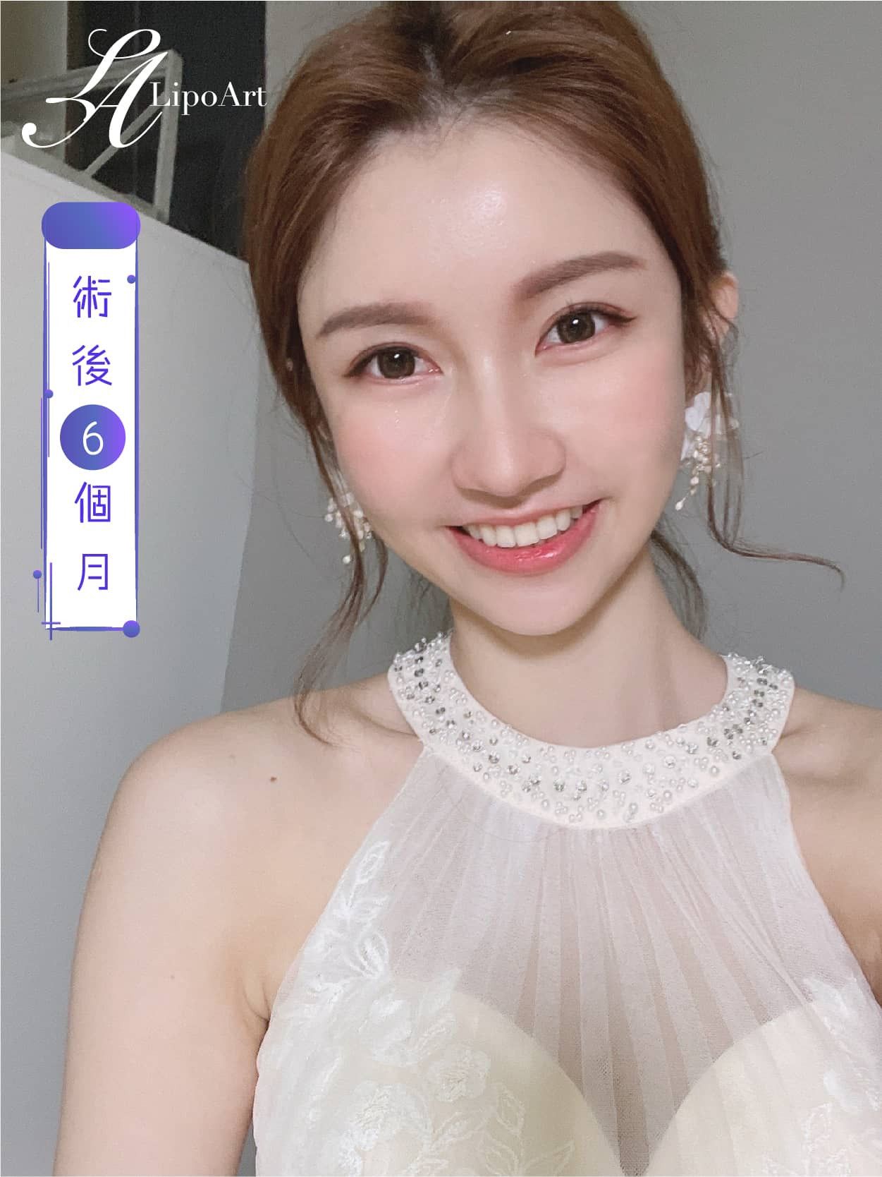萊波亞
