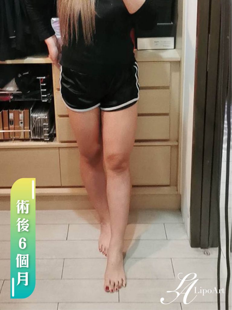 萊波亞