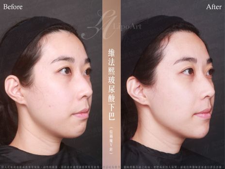 萊波亞