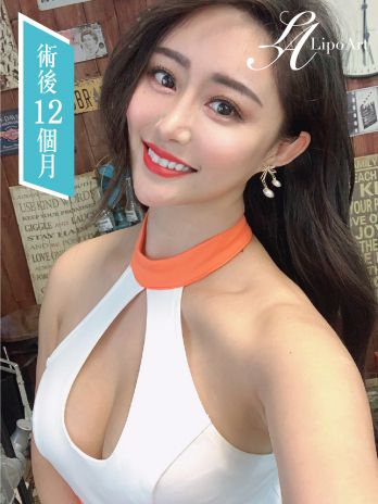 萊波亞