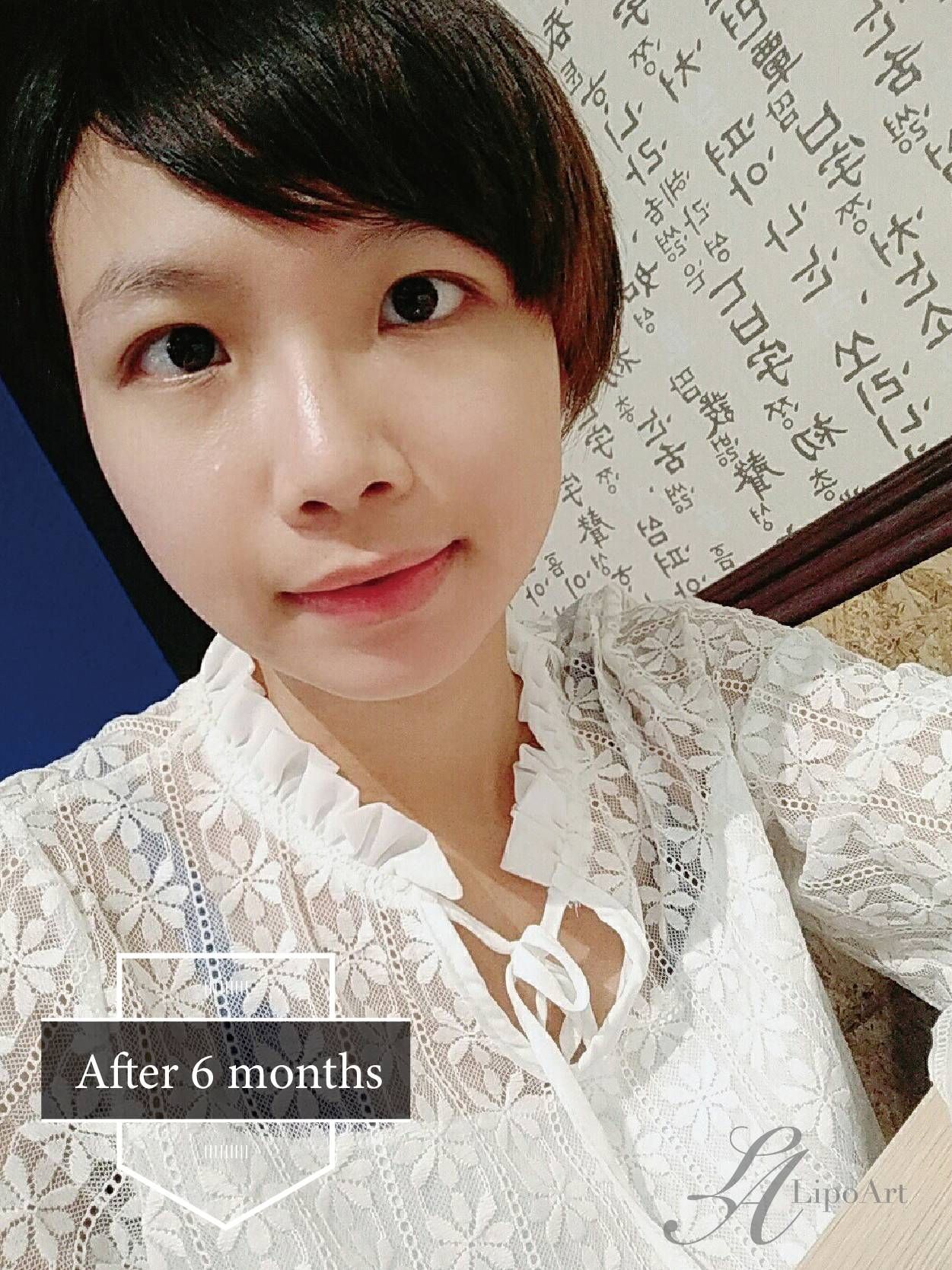 萊波亞