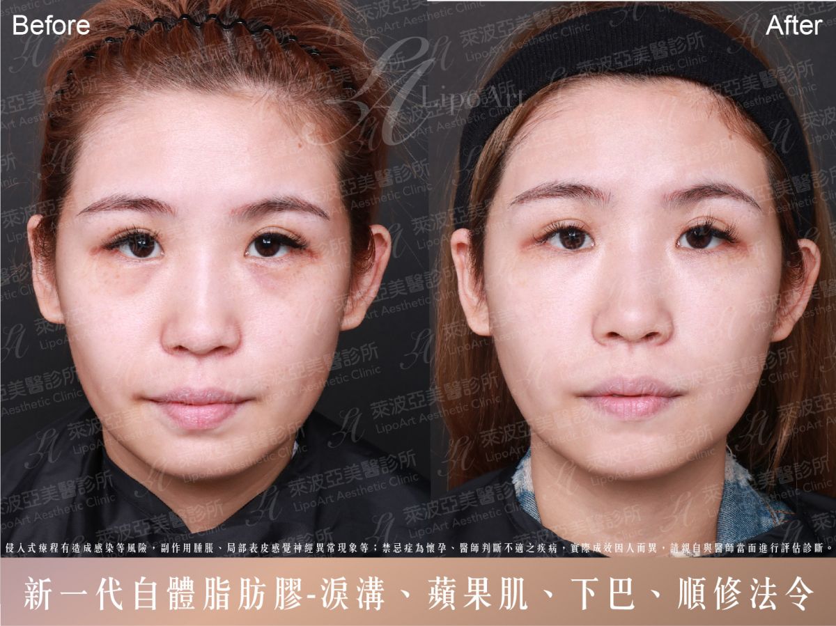 萊波亞