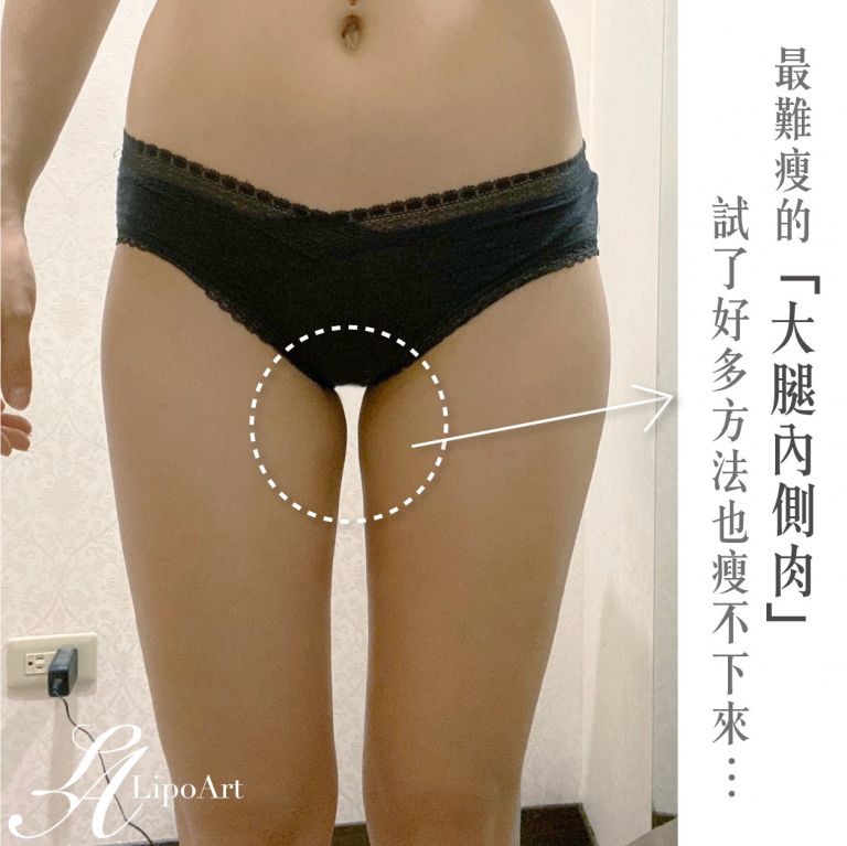 萊波亞