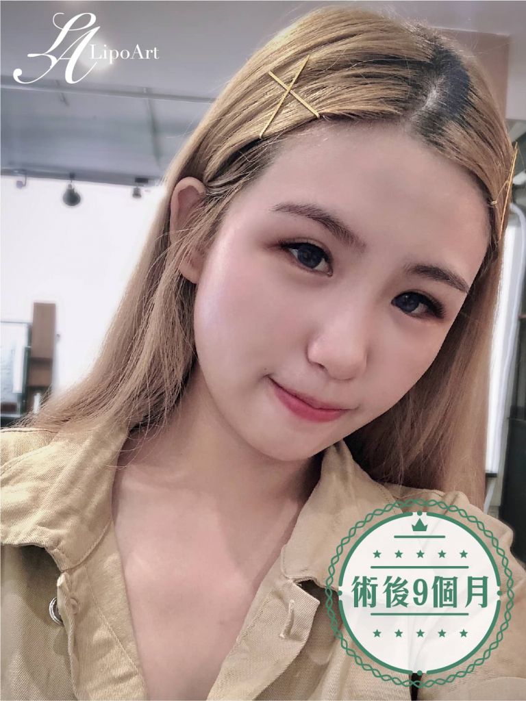 萊波亞