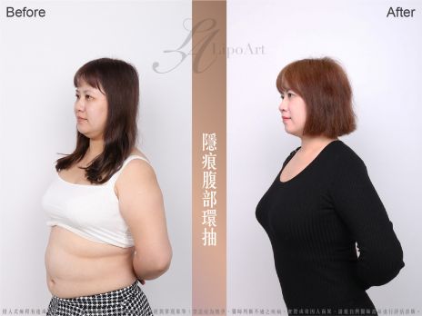 萊波亞